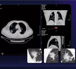 ̜ƼMвͻ׃Ayͨ^AIƻ߷βCTӰMвԄәzλԳ̶ȵĶSԄӈtoˆTٺY¹ڲMиxcMһ_\[Ԕ]