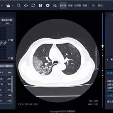 DAI¹ڷӰurϵyDزCT͹ڠurϵyɌFǰкڵȫo\Äµ˹ȫζg\ٶȺ;[Ԕ]