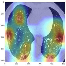 UϢƼ¹ڷo\ϵyаl˻CTӰ¹ڷo\ϵyF¹ڷԷԷ׵beҌFβCTӰвλõָܷ[Ԕ]